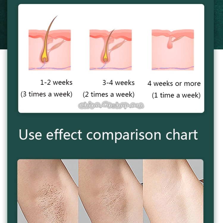 V-519 Home IPL Pulse Hair Removal Apparatus Laser Lip Armpit Hair Removal Apparatus,