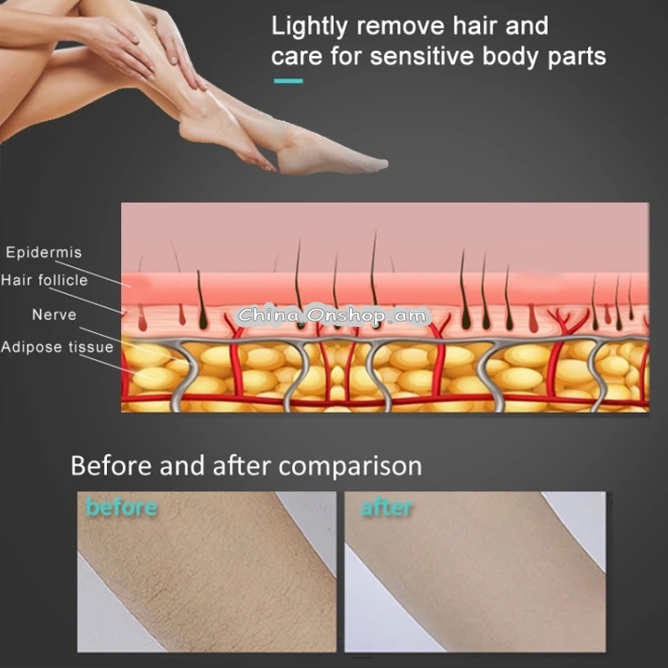 Home Painless Whole Body Laser Freezing Point Photon Hair Removal Instrument