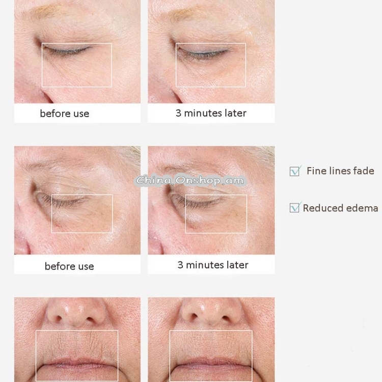 Eye / Lip Massager Reduce Eye Bags and Dark Circles without Battery