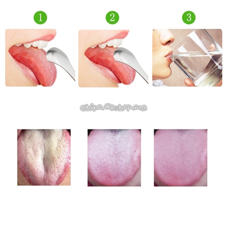 Tongue Cleaner Bad Breath Stainless Steel Cleaning Brush Tongue Scraper+Two-piece Set